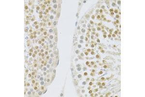 Immunohistochemistry of paraffin-embedded rat testis using SLC39A7 antibody (ABIN5971725) at dilution of 1/100 (40x lens). (SLC39A7 抗体)