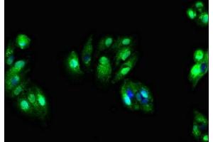 Immunofluorescent analysis of HepG2 cells using ABIN7171195 at dilution of 1:100 and Alexa Fluor 488-congugated AffiniPure Goat Anti-Rabbit IgG(H+L) (SDC4 抗体  (AA 19-145))