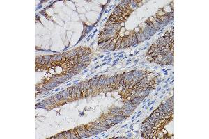 Immunohistochemistry (IHC) image for anti-Interleukin 18 Receptor 1 (IL18R1) (AA 19-320) antibody (ABIN3023691)