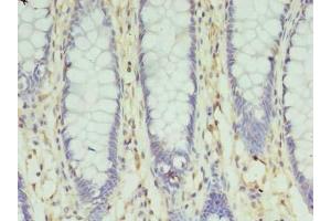 Immunohistochemistry (IHC) image for anti-Solute Carrier Family 35, Member F5 (SLC35F5) (AA 122-242) antibody (ABIN7170235)
