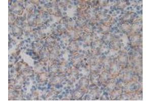 Detection of ITGaD in Rat Kidney Tissue using Polyclonal Antibody to Integrin Alpha D (ITGaD)