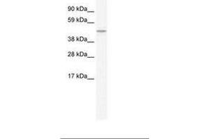 Image no. 1 for anti-Transmembrane Protein 108 (TMEM108) (C-Term) antibody (ABIN203178) (TMEM108 抗体  (C-Term))
