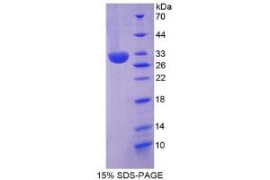 SDS-PAGE (SDS) image for Inter-alpha Globulin Inhibitor H2 Polypeptide (ITIH2) (AA 452-702) protein (His tag) (ABIN1981210) (ITIH2 Protein (AA 452-702) (His tag))