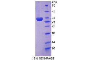 SDS-PAGE (SDS) image for Inter-alpha Globulin Inhibitor H2 Polypeptide (ITIH2) (AA 452-702) protein (His tag) (ABIN2125348)