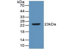 Western blot analysis of recombinant Mouse IL2. (IL-2 抗体  (AA 10-169))