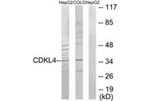 Western blot analysis of extracts from HepG2/COLO205 cells, using CDKL4 Antibody. (CDKL4 抗体  (AA 266-315))