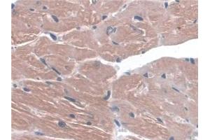 Detection of ITGa3 in Mouse Heart Tissue using Polyclonal Antibody to Integrin Alpha 3 (ITGa3) (ITGA3 抗体  (AA 33-236))
