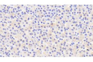 Detection of IDS in Human Liver Tissue using Polyclonal Antibody to Iduronate-2-Sulfatase (IDS) (IDS 抗体  (AA 95-289))