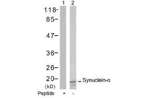 Image no. 1 for anti-Synuclein, alpha (SNCA) (Tyr125) antibody (ABIN197503) (SNCA 抗体  (Tyr125))