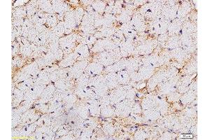 Formalin-fixed and paraffin embedded rat heart labeled with Anti-HCN4 Polyclonal Antibody, Unconjugated  at 1:200 followed by conjugation to the secondary antibody and DAB staining. (HCN4 抗体  (AA 501-600))