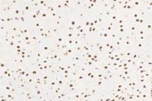 Immunohistochemistry (Paraffin-embedded Sections) (IHC (p)) image for anti-Ring Finger Protein 1 (RING1) antibody (ABIN7075467)