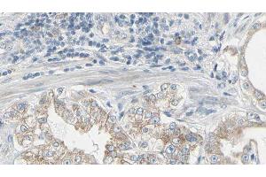 ABIN6277958 at 1/100 staining Human prostate tissue by IHC-P. (GNB2 抗体  (C-Term))