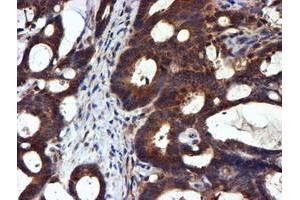 Image no. 4 for anti-NADH Dehydrogenase (Ubiquinone) Complex I, Assembly Factor 7 (NDUFAF7) antibody (ABIN1499667) (NDUFAF7 抗体)