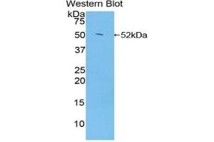 Western blot analysis of the recombinant protein. (Glucocorticoid Receptor 抗体  (AA 564-733))