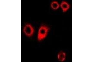 Immunofluorescent analysis of PDI staining in Hela cells.