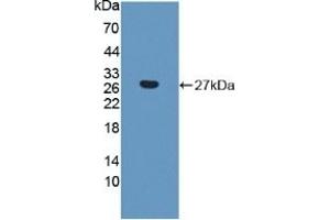 Detection of Recombinant CTHRC1, Human using Polyclonal Antibody to Collagen Triple Helix Repeat Containing Protein 1 (CTHRC1) (CTHRC1 抗体  (AA 31-243))