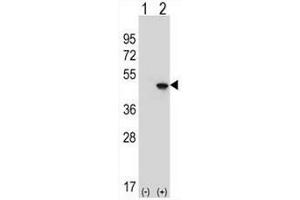 Western blot analysis of EIF4A2 (arrow) using rabbit polyclonal EIF4A2 Antibody (C-term) . (EIF4A2 抗体  (C-Term))