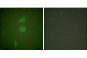 Immunofluorescence analysis of NIH-3T3 cells, using HDAC5 Antibody. (HDAC5 抗体  (AA 1073-1122))