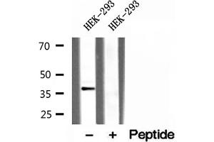 Western blot analysis of extracts of HEK-293 cells, using CLTA antibody. (CLTA 抗体)