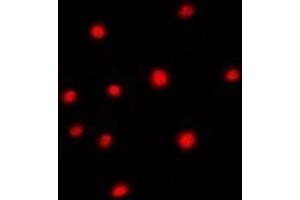 Immunofluorescence (IF) image for anti-ATP-Binding Cassette, Sub-Family C (CFTR/MRP), Member 9 (ABCC9) (N-Term) antibody (ABIN7303130)