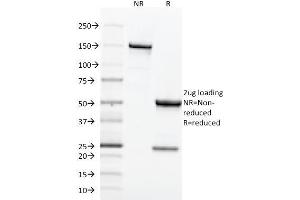 SDS-PAGE Analysis Purified CD71 Mouse Monoclonal Antibody (TFRC/1818). (Transferrin Receptor 抗体  (AA 94-212))