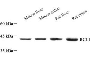 Western blot analysis of RCL1 (ABIN7075482) at dilution of 1: 500 (RCL1 抗体)