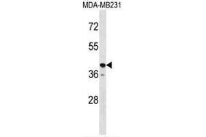 TAS2R31 Antibody (C-term) western blot analysis in MDA-MB231 cell line lysates (35µg/lane). (TAS2R31 抗体  (C-Term))