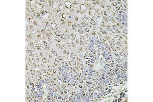 Immunohistochemistry of paraffin-embedded human esophagus using TMC1 antibody (ABIN5996250) at dilution of 1/100 (40x lens). (TMC1 抗体)