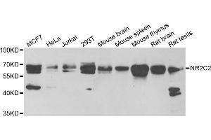 Western blot analysis of extracts of various cell lines, using NR2C2 antibody (ABIN5973822) at 1/1000 dilution. (TR4 抗体)