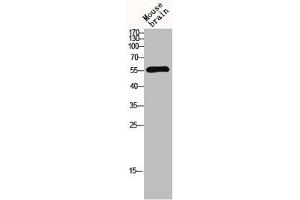 Western blot analysis of mouse-brain lysis using MMP-13 antibody. (MMP13 抗体  (N-Term))