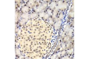 Immunohistochemistry of paraffin-embedded rat pancreas using PAWR Antibody (ABIN1874043) at dilution of 1:200 (40x lens). (PAWR 抗体)