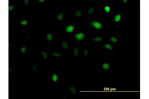 Immunofluorescence of purified MaxPab antibody to ANKRD1 on HeLa cell. (ANKRD1 抗体  (AA 1-319))