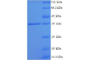 SDS-PAGE (SDS) image for Asparaginase Homolog (ASPG) (AA 24-205) protein (His-SUMO Tag) (ABIN5709007) (Asparaginase Protein (AA 24-205) (His-SUMO Tag))