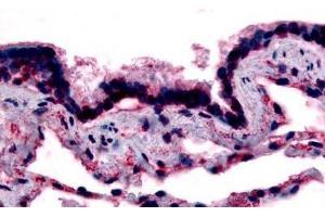 Human Respiratory Epithelium, Bronchial Smooth Muscle, and Alveoli (formalin-fixed, paraffin-embedded) stained with CAV1 antibody ABIN213407 at 15-20 ug/ml followed by biotinylated goat anti-rabbit IgG secondary antibody ABIN481713, alkaline phosphatase-str . (Caveolin-1 抗体  (N-Term))