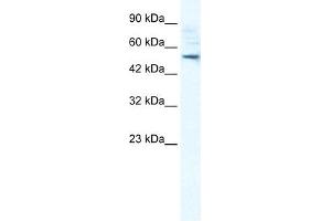 SMPDL3B antibody used at 1 ug/ml to detect target protein. (SMPDL3B 抗体  (N-Term))