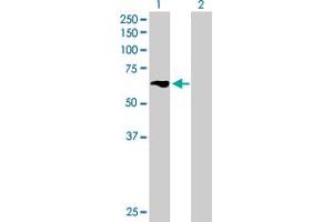 Western Blot analysis of TBRG4 expression in transfected 293T cell line by TBRG4 MaxPab polyclonal antibody.