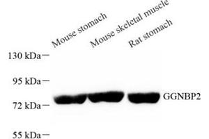 Western blot analysis of GGNBP2 (ABIN7074017) at dilution of 1: 1000 (GGNBP2 抗体)