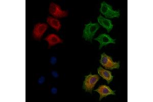 ABIN7094259 and ABIN7098306 staining HepG2 cells by IF/ICC. (GLTP 抗体  (Internal Region))