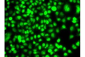 Immunofluorescence analysis of A549 cells using ETS2 antibody. (ETS2 抗体)