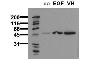 Western Blotting (WB) image for anti-Glycogen Synthase Kinase 3 alpha (GSK3a) (pSer21) antibody (ABIN126804) (GSK3 alpha 抗体  (pSer21))