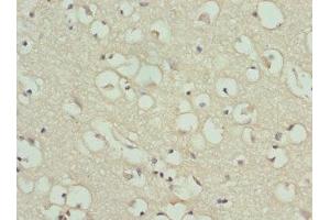 Immunohistochemistry of paraffin-embedded human brain tissue using ABIN7154206 at dilution of 1:100 (PYGB 抗体  (AA 6-843))