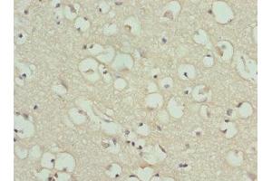 Immunohistochemistry of paraffin-embedded human brain tissue using ABIN7154206 at dilution of 1:100 (PYGB 抗体  (AA 6-843))