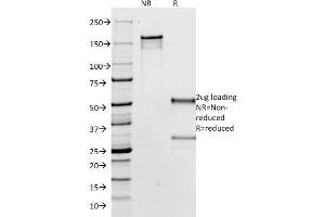 SDS-PAGE Analysis Purified IgG Mouse Monoclonal Antibody (IG266). (IGHG 抗体  (CF®488A))