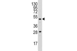 Western blot analysis of Urokinase antibody and A2058 lysate (PLAU 抗体  (AA 60-90))