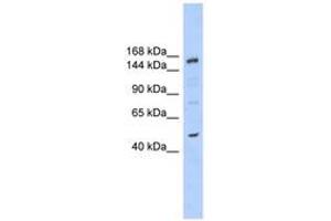 Image no. 1 for anti-SNF2 Histone Linker PHD RING Helicase, E3 Ubiquitin Protein Ligase (SHPRH) (AA 251-300) antibody (ABIN6742697)