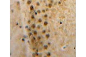 Used in DAB staining on fromalin fixed paraffin-embedded Brain tissue (Axin 抗体  (AA 653-862))