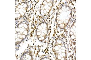 Immunohistochemistry (IHC) image for anti-Cullin 1 (CUL1) (AA 500-776) antibody (ABIN3015864)