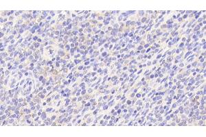 Detection of POLg1 in Human Spleen Tissue using Polyclonal Antibody to Polymerase DNA Directed Gamma 1 (POLg1) (POLG 抗体  (AA 1041-1239))