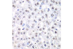 Immunohistochemistry (Paraffin-embedded Sections) (IHC (p)) image for anti-Non-POU Domain Containing, Octamer-Binding (NONO) (AA 1-300) antibody (ABIN6144713)