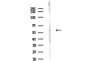 anti-Lysophosphatidylcholine Acyltransferase 4 (LPCAT4) (C-Term) antibody
